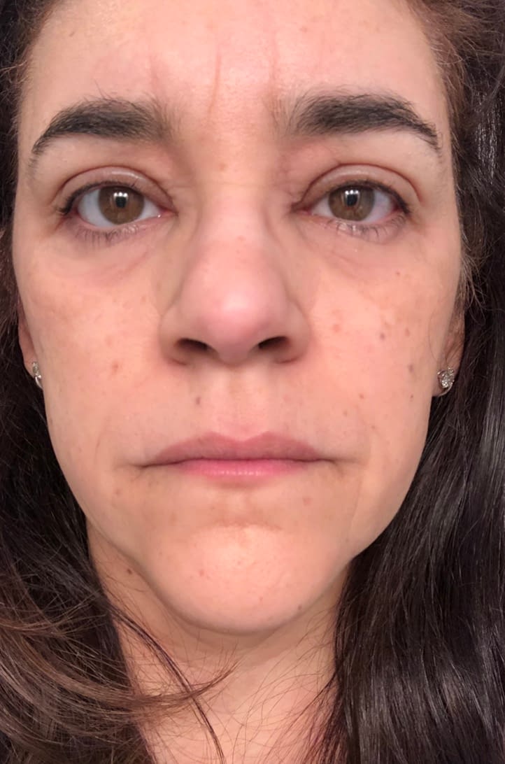 Allergies Through the Years Lifestyle By G